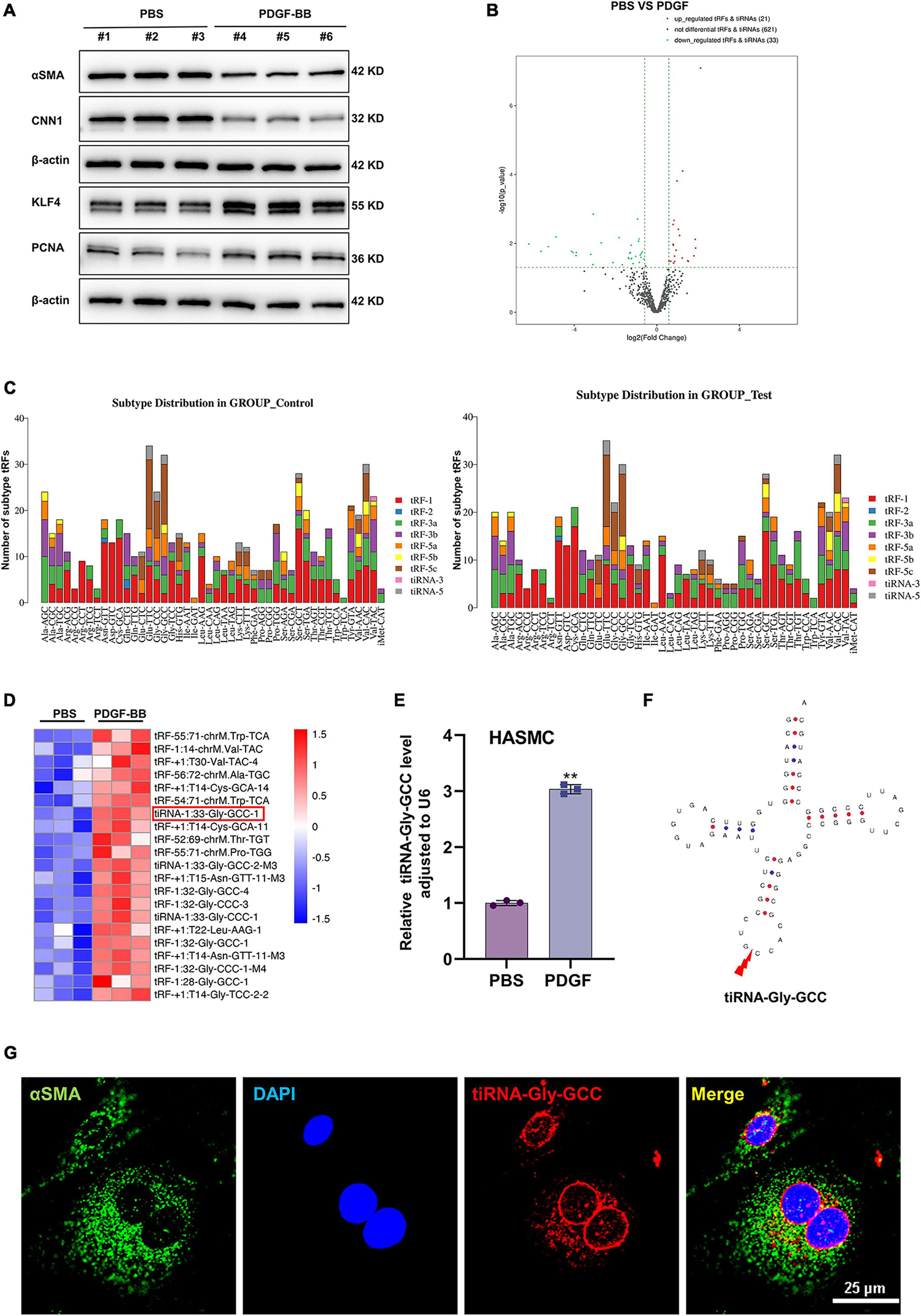 Inhibition of tiRNA-Gly-GCC ameliorates neointimal formation via CBX3-mediated VSMCs phenotypic switching
